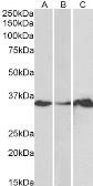 Anti-LASP1 antibody used in Western Blot (WB). GTX21301