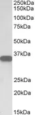 Anti-CD20 antibody, C-term used in Western Blot (WB). GTX21310