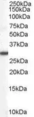 Anti-DDAH2 antibody used in Western Blot (WB). GTX21383