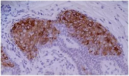 Anti-Cytokeratin 10 antibody [VIK-10] used in IHC (Paraffin sections) (IHC-P). GTX21421