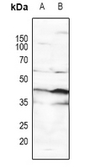 Anti-p53 (phospho Ser15) antibody used in Western Blot (WB). GTX21431