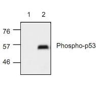 Anti-p53 (phospho Ser15) antibody used in Western Blot (WB). GTX21431