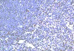 Anti-TLR2 antibody used in Immunohistochemistry (IHC). GTX21655