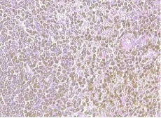 Anti-CXCR4 antibody used in IHC (Paraffin sections) (IHC-P). GTX21671