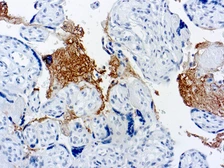 Anti-Thrombospondin antibody [A6-1] used in IHC (Paraffin sections) (IHC-P). GTX21823