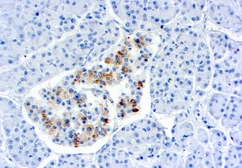 Anti-TIMP2 antibody [3A4] used in IHC (Paraffin sections) (IHC-P). GTX21828