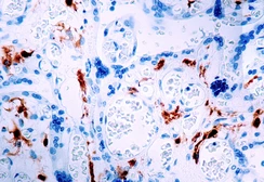 Anti-Factor XIIIA antibody [AC-1A1] used in IHC (Paraffin sections) (IHC-P). GTX21834