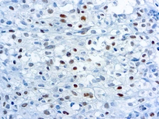 Anti-Myogenin antibody [F5D] used in IHC (Paraffin sections) (IHC-P). GTX21835
