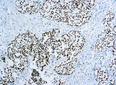 Anti-XRCC1 antibody [33-2-5] used in IHC (Paraffin sections) (IHC-P). GTX21838