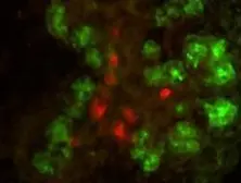 Anti-Elastase antibody used in Immunocytochemistry/ Immunofluorescence (ICC/IF). GTX21876