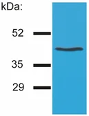 Anti-HLA-G antibody [MEM-G/4] used in Western Blot (WB). GTX21887