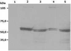 Anti-LYN antibody [LYN-01] used in Western Blot (WB). GTX21890