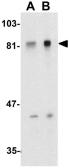 Anti-ADAM10 antibody used in Western Blot (WB). GTX21997