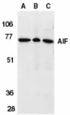 Anti-AIF antibody used in Western Blot (WB). GTX21998