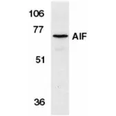 Anti-AIF antibody used in Western Blot (WB). GTX21999
