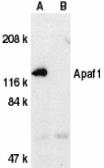 Anti-APAF1 antibody used in Western Blot (WB). GTX22000