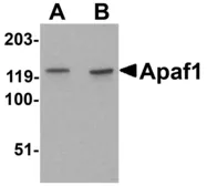 Anti-APAF1 antibody used in Immunocytochemistry/ Immunofluorescence (ICC/IF). GTX22001