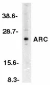 Anti-NOL3 antibody used in Western Blot (WB). GTX22003
