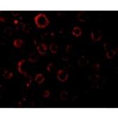 Anti-MADD antibody used in Immunocytochemistry/ Immunofluorescence (ICC/IF). GTX22043