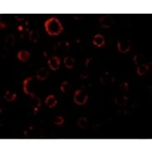 Anti-MADD antibody used in Immunocytochemistry/ Immunofluorescence (ICC/IF). GTX22043