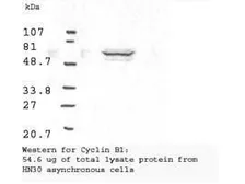 Anti-Cyclin B1 antibody used in Western Blot (WB). GTX22096