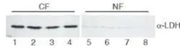 Anti-Lactate Dehydrogenase antibody used in Western Blot (WB). GTX22101