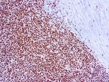 Anti-RPA32 antibody [9H8] used in IHC (Paraffin sections) (IHC-P). GTX22175