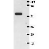 Anti-CD41 antibody [MEM-06] used in Western Blot (WB). GTX22211