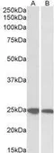 Anti-GRB2 antibody used in Western Blot (WB). GTX22234