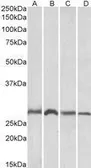 Anti-SIAH1 antibody used in Western Blot (WB). GTX22237