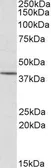 Anti-PSCDBP antibody, N-term used in Western Blot (WB). GTX22247