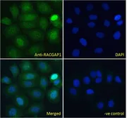 Anti-RACGAP1 antibody used in Immunocytochemistry/ Immunofluorescence (ICC/IF). GTX22270