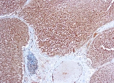 Anti-VEGF Receptor 1 antibody used in IHC (Paraffin sections) (IHC-P). GTX22350