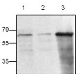 Anti-CD40L / CD154 antibody used in Western Blot (WB). GTX22391