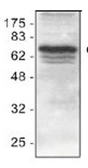 Anti-cIAP1 antibody used in Western Blot (WB). GTX22399