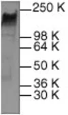Anti-Her2 / ErbB2 antibody used in Western Blot (WB). GTX22428