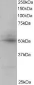 Anti-AIBZIP antibody used in Western Blot (WB). GTX22474