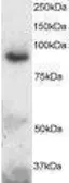 Anti-ADAM8 antibody used in Western Blot (WB). GTX22475