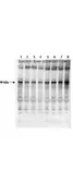 Anti-Glycogen synthase 1 (phospho Ser641) antibody used in Western Blot (WB). GTX22479