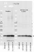 Anti-Myosin Light Chain 2 (phospho Ser19) antibody used in Western Blot (WB). GTX22480