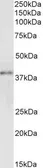Anti-GRAP2 antibody used in Western Blot (WB). GTX22520