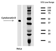 Anti-Cytokeratin 8 antibody [C-43] used in Western Blot (WB). GTX22530