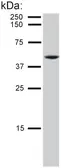 Anti-Cytokeratin 8 antibody [C-51] used in Western Blot (WB). GTX22531