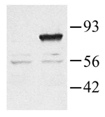 Anti-RGS3 antibody used in Western Blot (WB). GTX22564