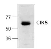 Anti-CIKS antibody used in Western Blot (WB). GTX22570