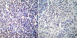 Anti-NFAT1 antibody [25A10.D6.D2] used in IHC (Paraffin sections) (IHC-P). GTX22722