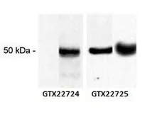 Anti-CaMKII alpha antibody [6G9] used in Western Blot (WB). GTX22725