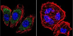 Anti-alpha Adaptin antibody [AP6] used in Immunocytochemistry/ Immunofluorescence (ICC/IF). GTX22730