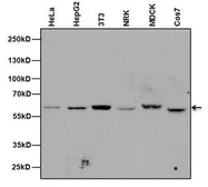 Anti-Nucleoporin p62 antibody [RL31] used in Western Blot (WB). GTX22736
