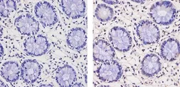 Anti-Thyroid Hormone Receptor beta antibody [J52] used in IHC (Paraffin sections) (IHC-P). GTX22744